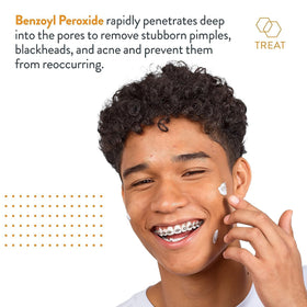AcneFree Traitement Localisé Acné 50g avec texture crème