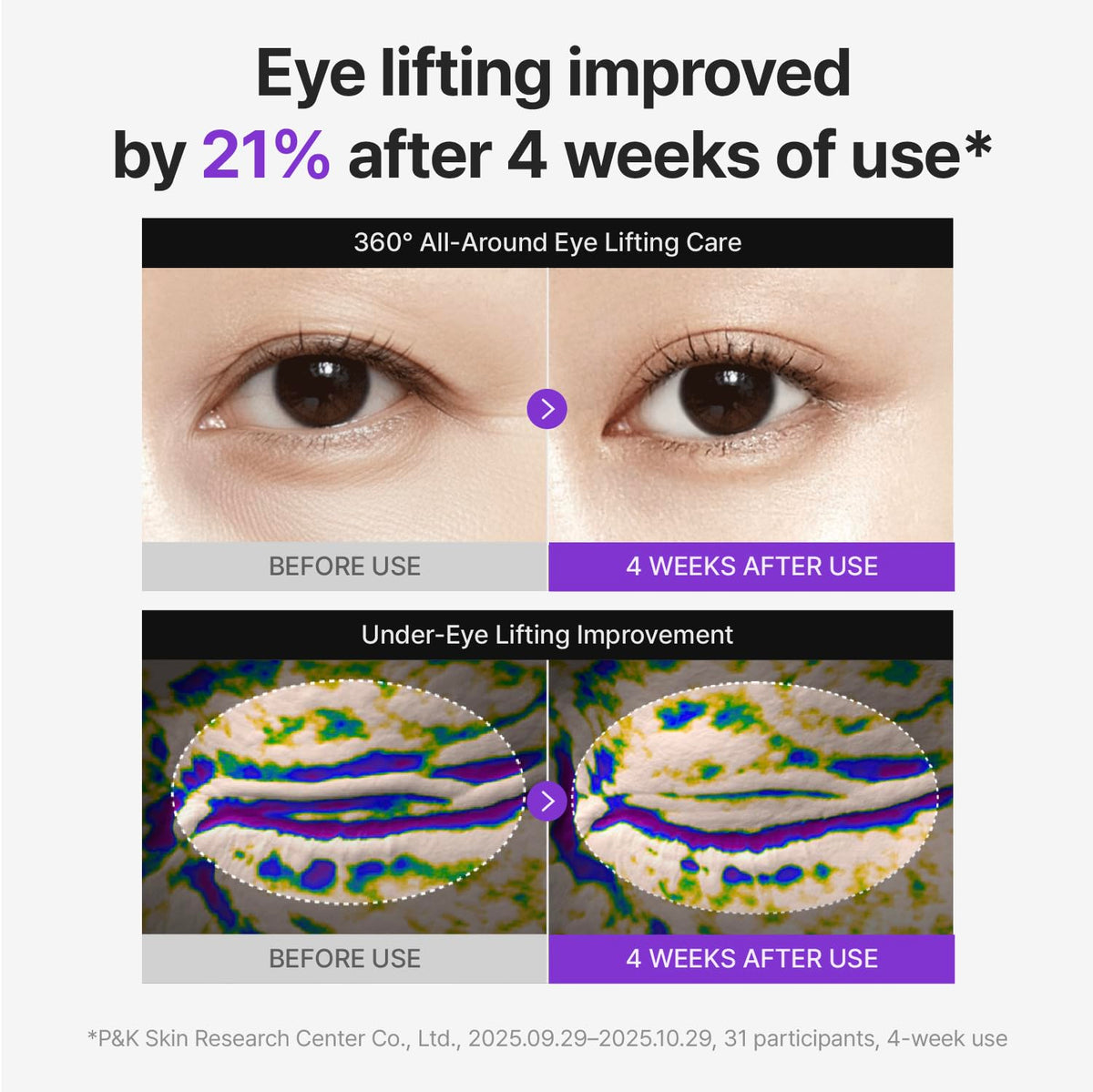 Application de la crème CENTELLIAN 24 sur le contour des yeux