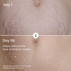 Application de la crème MAËLYS B-FLAT sur le ventre