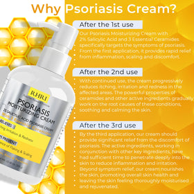 Application de la crème psoriasis Rida sur le cuir chevelu