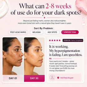 Application de la crème Seora skins sur le visage