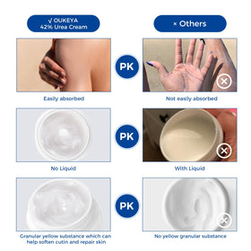 Application de la crème sur un coude sec.