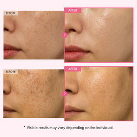 Application de la crème TOSOWOONG sur le visage