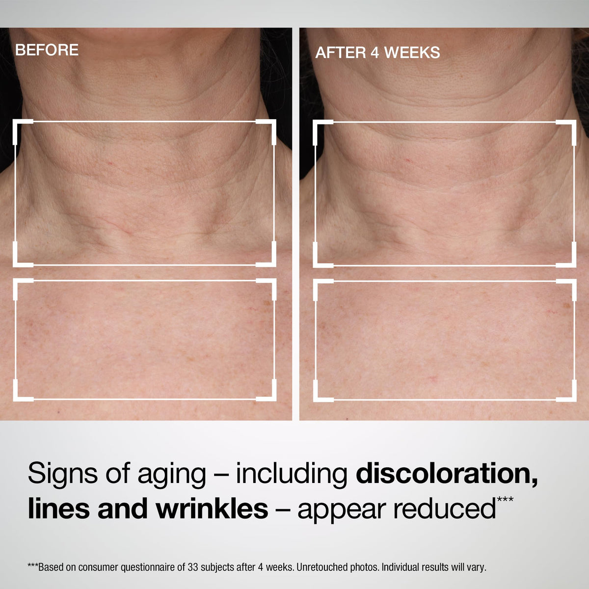 Application de la lotion StriVectin sur le cou