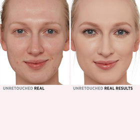 Application de la poudre Bye Bye Pores sur une peau nue