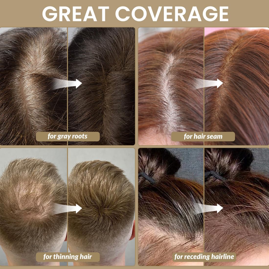 Application de la poudre VOLLUCK sur la ligne des cheveux