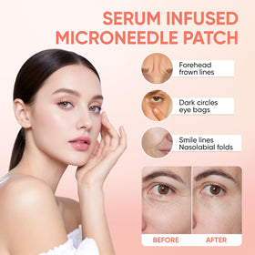 Application des patches NOVALIFT sous les yeux