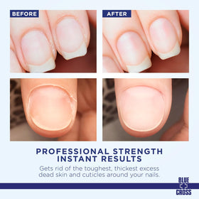 Application du Démélant de Cuticules Blue Cross sur les ongles