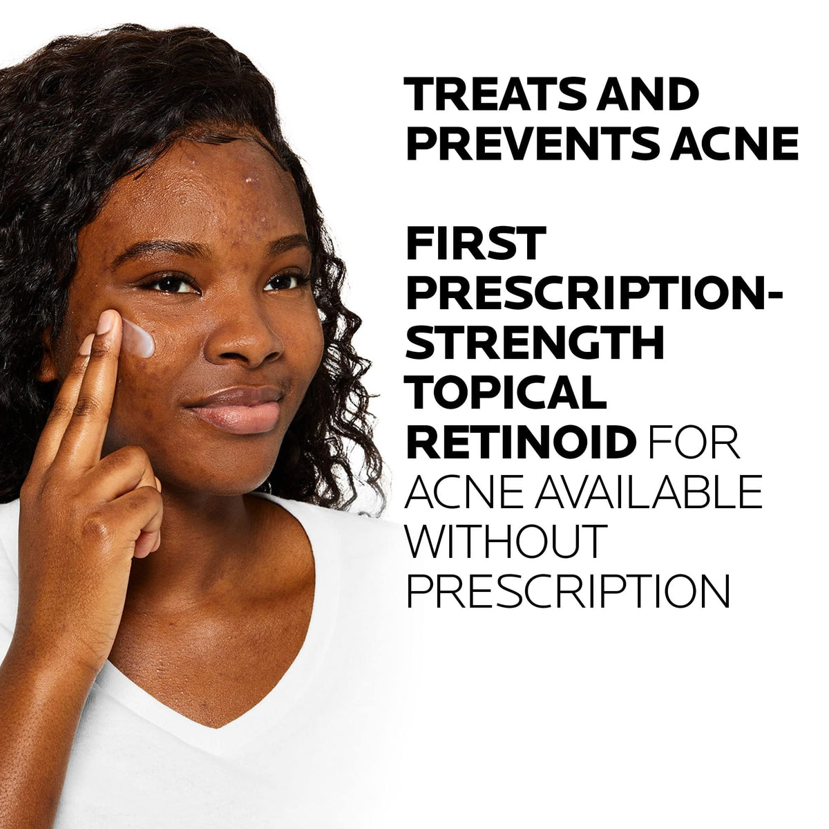Application du gel Effaclar Adapalène sur un visage propre
