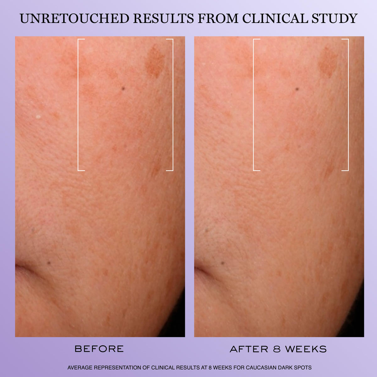 Application du sérum Lancôme Rénergie H.C.F. sur le visage