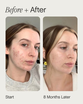 Application du sérum Topicals Faded sur la peau
