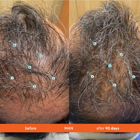 Application du shampooing Revita ds labs sur des cheveux mouillés