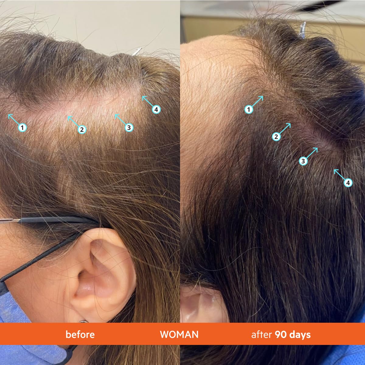 Application du shampooing Revita ds labs sur des cheveux mouillés