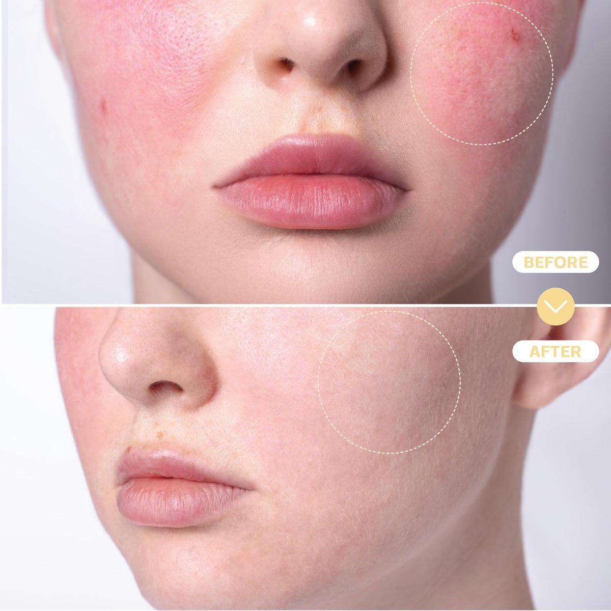 Application du spray d'acide hypochloreux sur le visage