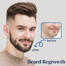 Application du spray de croissance capillaire sur les cheveux