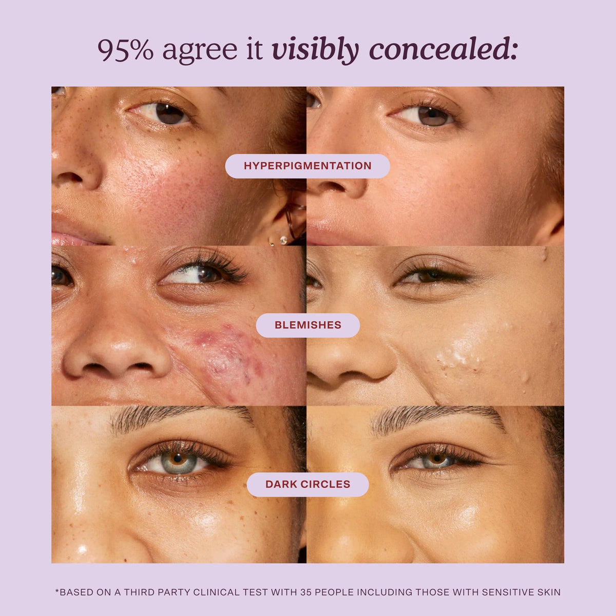 Avant et après application du Sérum Hydratant Concealer