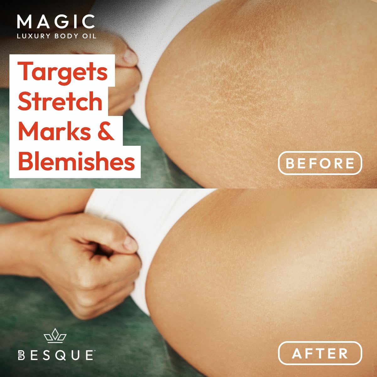 Besque Magic Body Oil près de fleurs pour une ambiance spa