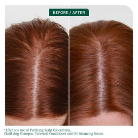 Biolage Shampoo Clarifiant Scalp Sync 33,8 fl oz vue arrière avec ingrédients