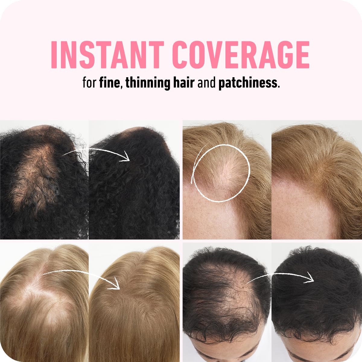 Boldify Fibres Capillaires Clairsemés 28,5g application sur cheveux