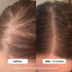 BONDIBOOST Après-Shampooing Anti-Chute 500ml vue avant