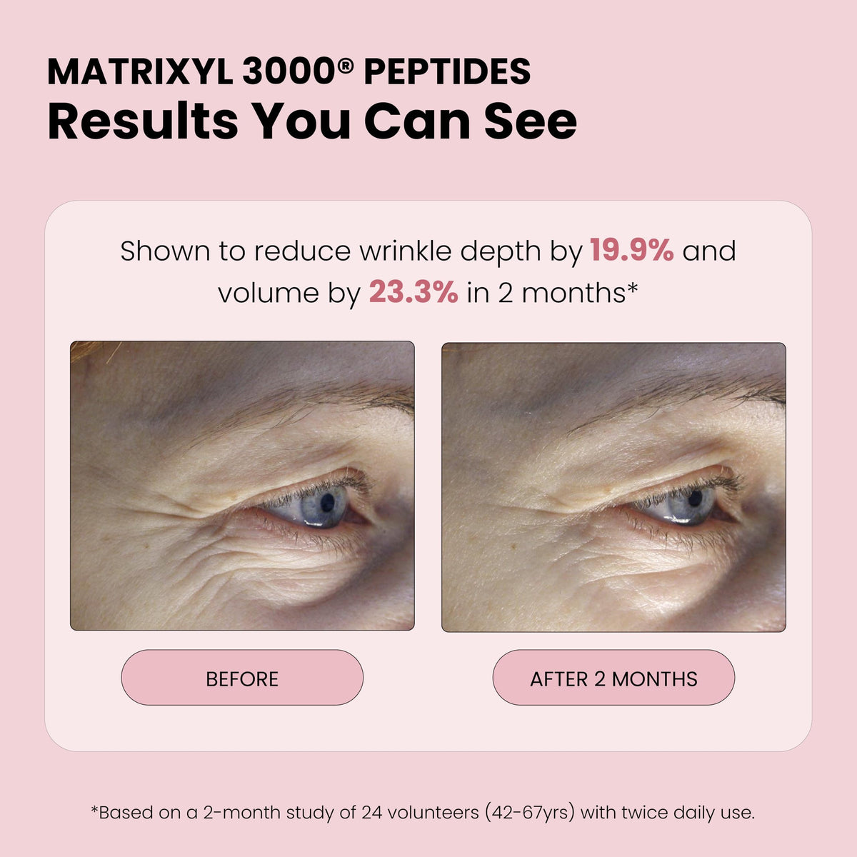 Brume de rose Simplified Skin 281g avec arrière-plan floral