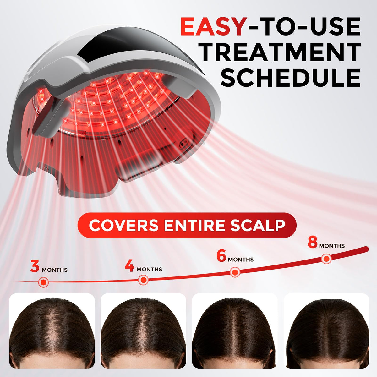 Casque OVEKPA avec lampes laser disposées en matrice pour une couverture uniforme