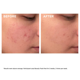 CLARINS Beauty Flash Peel sur une table avec des éléments de beauté