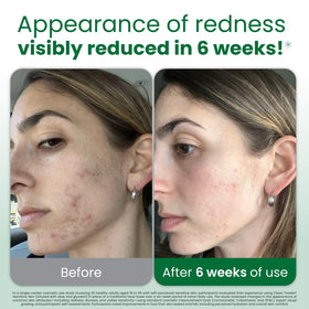 CLEAN SKIN CLUB Serviettes Nettoyantes Peau Sensible XL serviette dépliée
