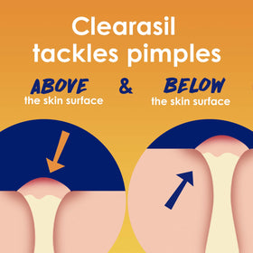 Clearasil lingettes nettoyantes 5-en-1 à l'intérieur du paquet