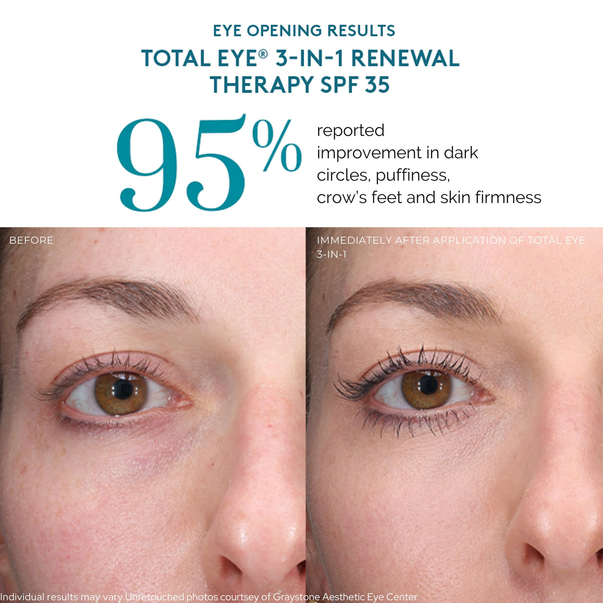 Colorescience Total Eye 3-en-1 arrière de l'emballage