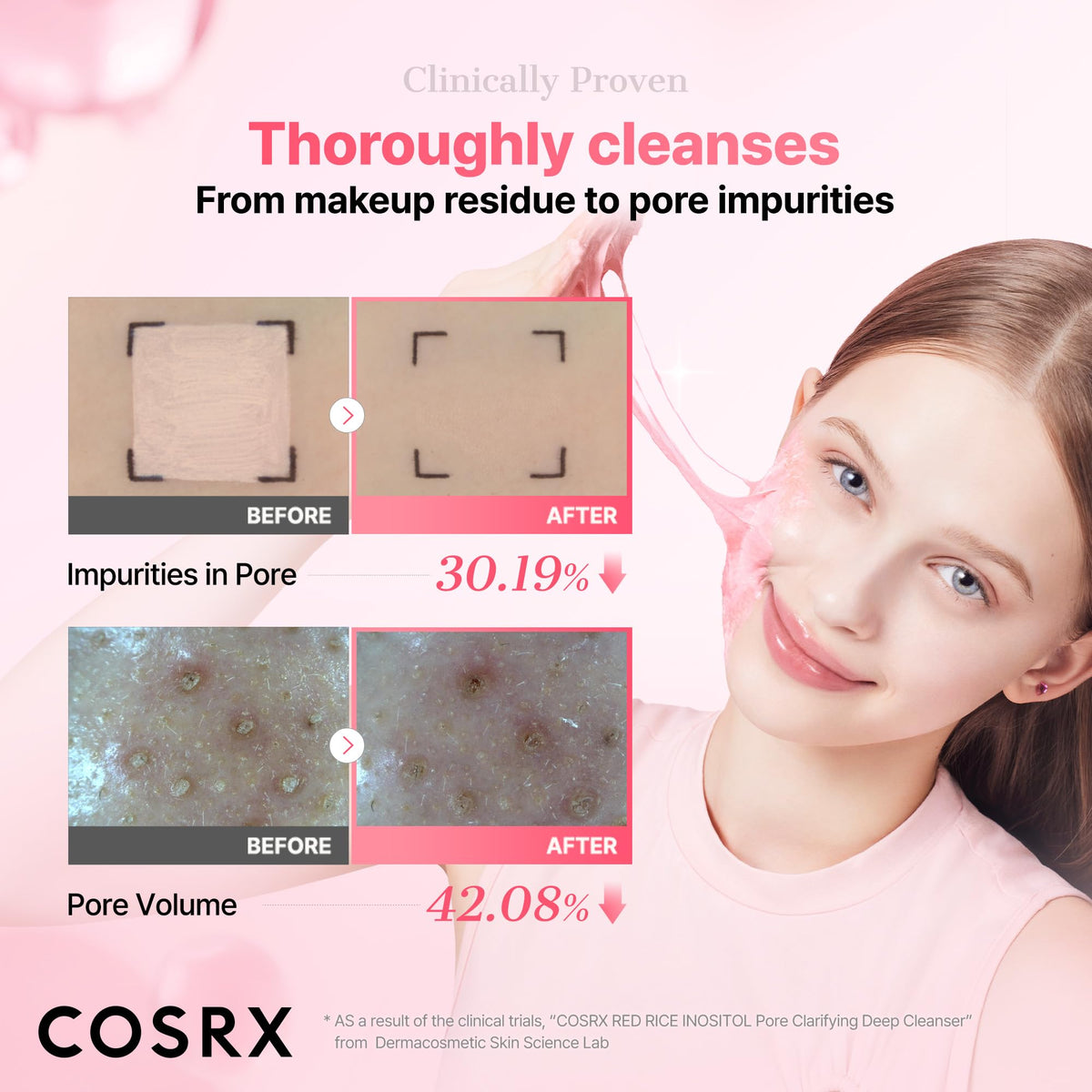 COSRX Nettoyant Pore Profond 150ml packaging vu de côté
