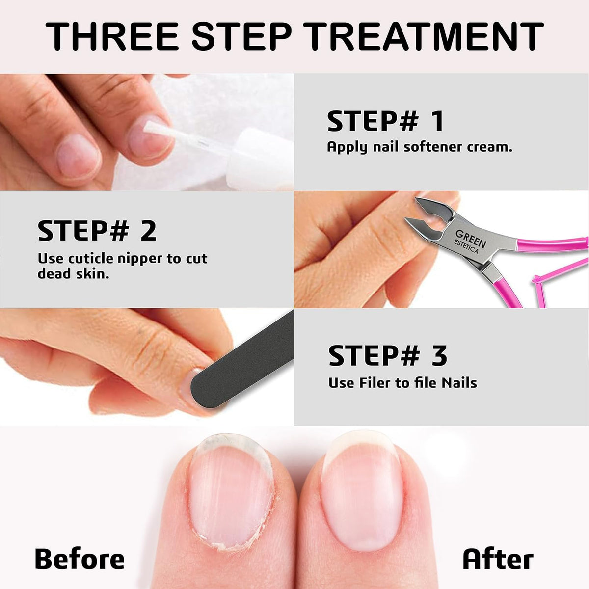 Couteau à cuticules GREEN ESTETICA avec son étui