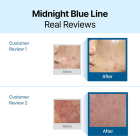 Crème Apaisante Bleue DearKlairs sur un fond naturel