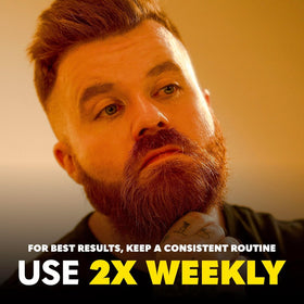 Derma Roller The Beard Club sur fond neutre, présentation du produit