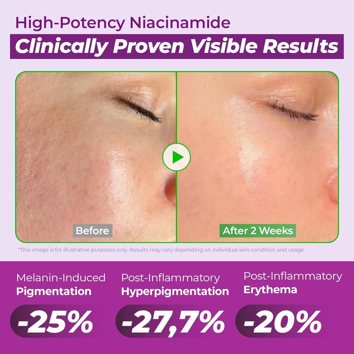 Détail de la texture du sérum JUMISO 20% Niacinamide