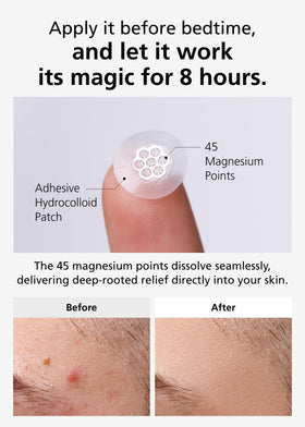 Détail des points de magnésium sur le patch DWEasyDerm