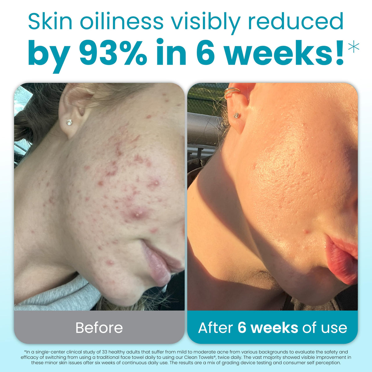 Détail des serviettes CLEAN SKIN CLUB avec texture exfoliante