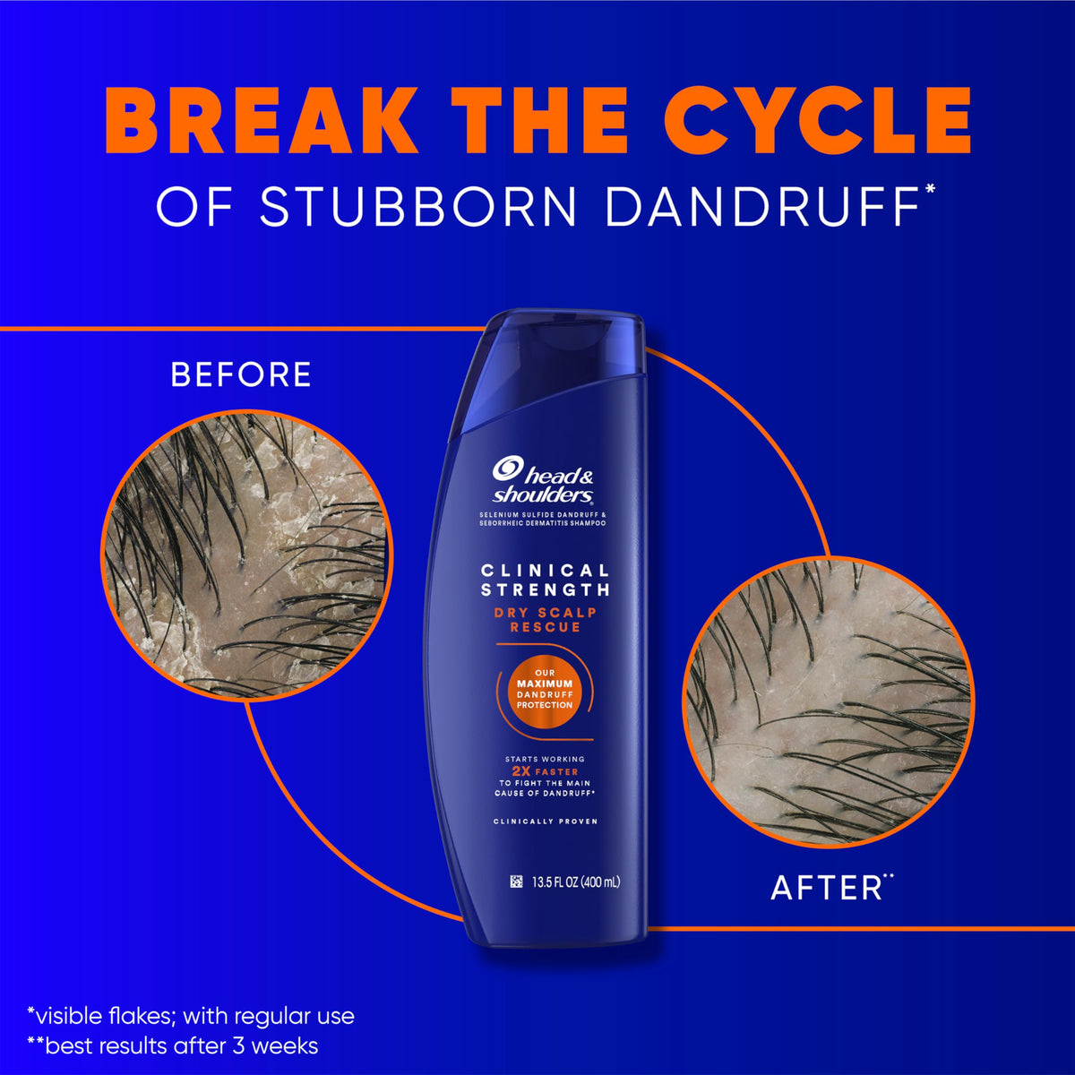 Détail du flacon d'après-shampooing Head & Shoulders