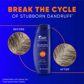 Détail du flacon d'après-shampooing Head & Shoulders
