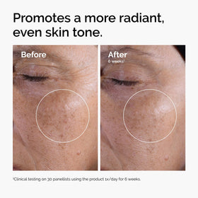 Détail du flacon de tonique exfoliant The Ordinary avec étiquette