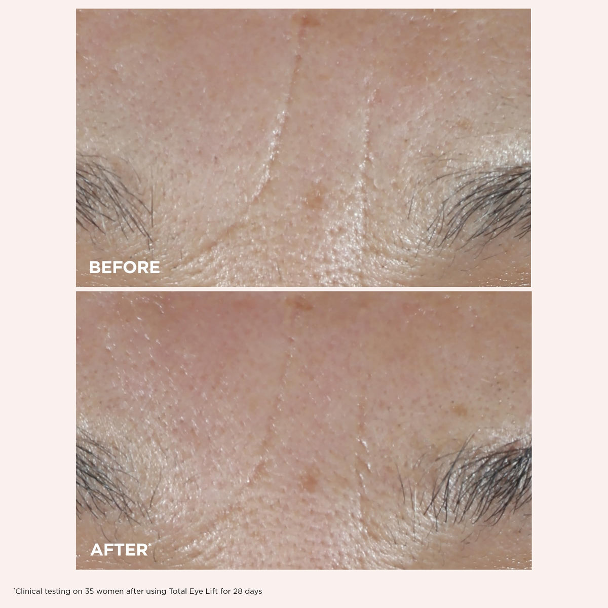 Détail du Total Eye Lift CLARINS avec applicateur