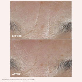 Détail du Total Eye Lift CLARINS avec applicateur
