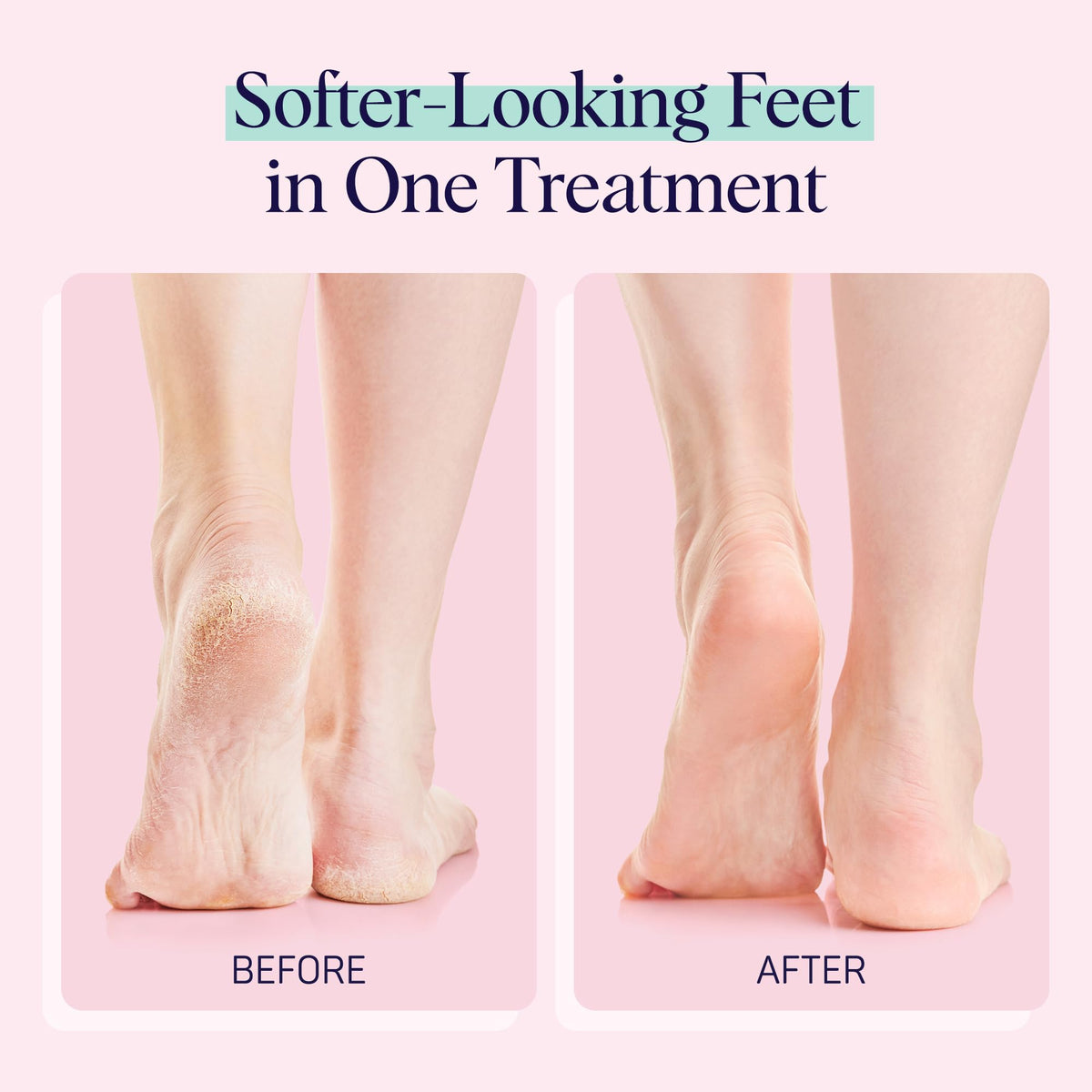 Détail sur le matériau des chaussettes SpaLife, texture douce