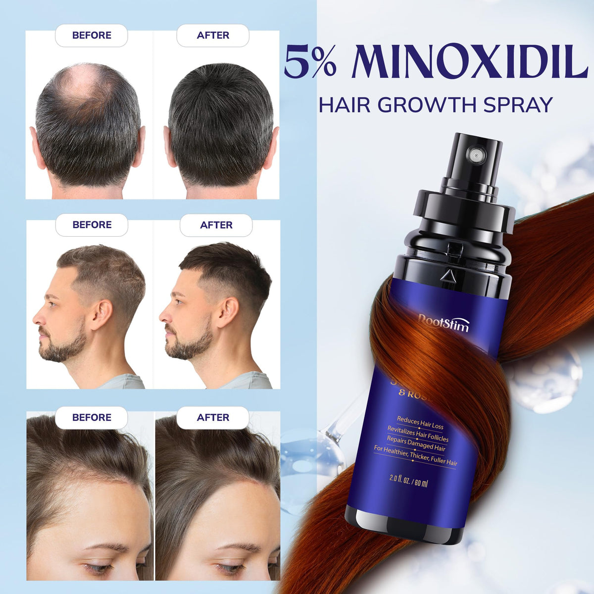 Détails de la formule à 5% de Minoxidil et romarin