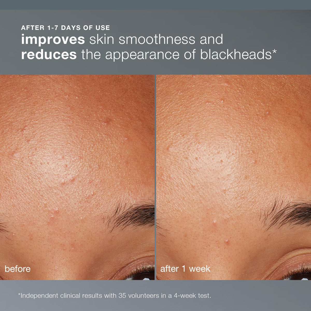 Détails de la texture de Dermalogica Daily Microfoliant en poudre