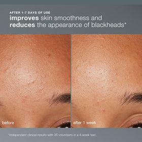 Détails de la texture de Dermalogica Daily Microfoliant en poudre