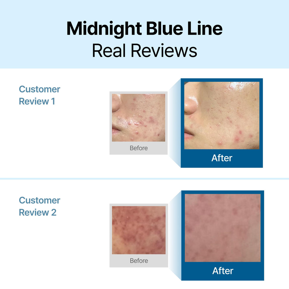 Détails de la texture de la Crème Apaisante Bleue DearKlairs