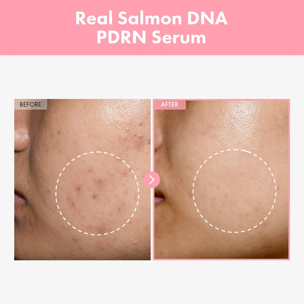 Détails du flacon de sérum TOSOWOONG Peptide Rose 12 PDRN