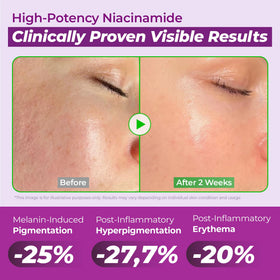 Détails du flacon JUMISO 20% Niacinamide avec étiquette clairement visible