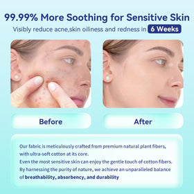 Ditoi Serviettes Éphémères XXL humides pour démaquillage